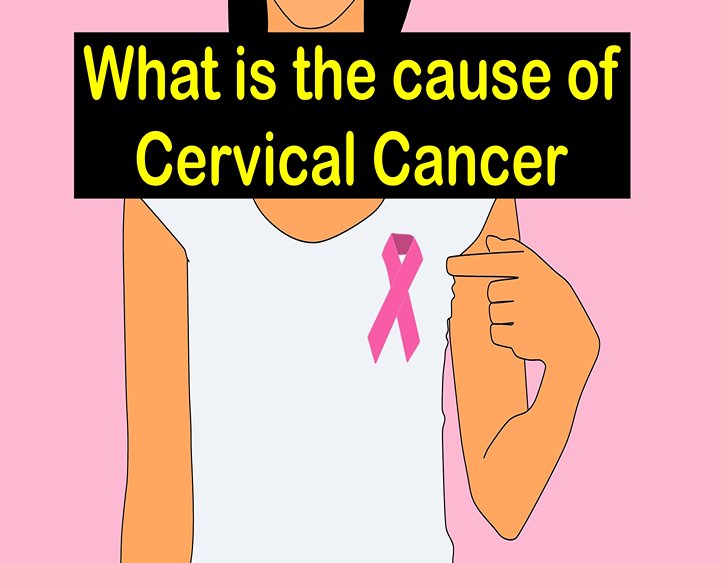 What is the cause of Cervical Cancer