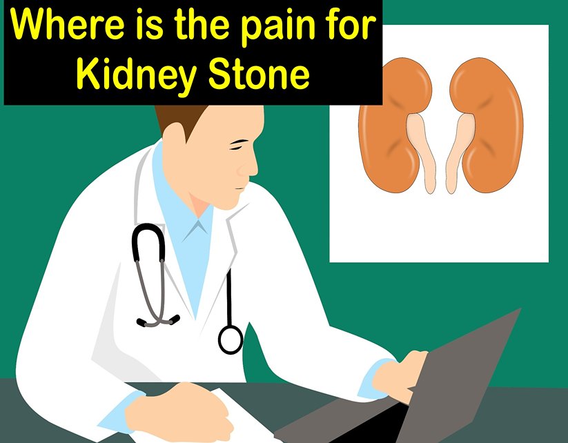 Where is the pain for Kidney Stone