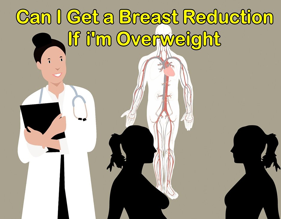 Can I Get a Breast Reduction If i'm Overweight