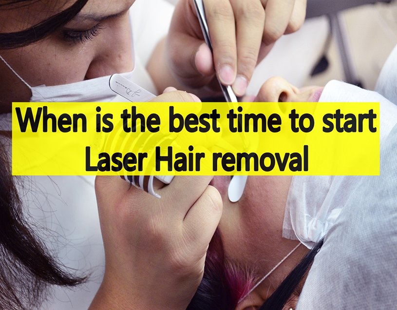 when is the best time to start laser hair removal